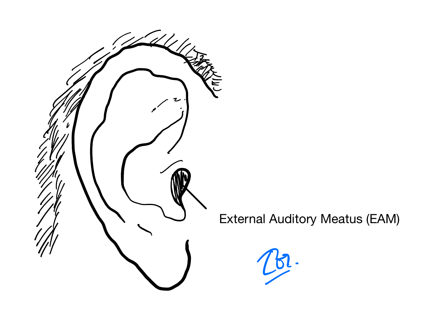จุดอ้างอิง External Auditory Meatus (EAM) สำหรับวัดระดับความสูงของ ventriculostomy